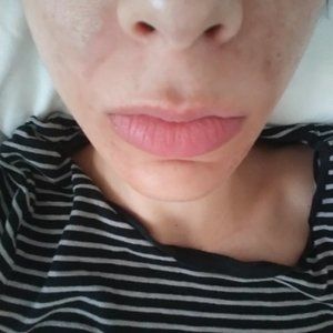 lactic acid peel 50% vegan made to order/chemical peel facial exfoliation